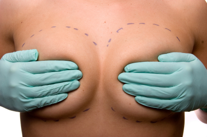 breast augmentation surgery